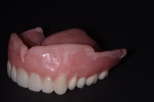 Complete Dentures Staffordville CT 6077